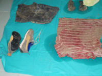 Cadavere sulla spiaggia di Campomarino, s’indaga per omicidio
