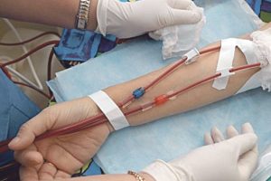Scompare la dialisi dalla rete ospedaliera, allarme dell’Aned per Venafro e Larino