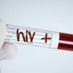 13 casi di Aids nel 2023, è allarme