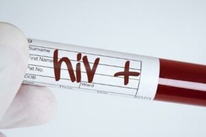 13 casi di Aids nel 2023, è allarme